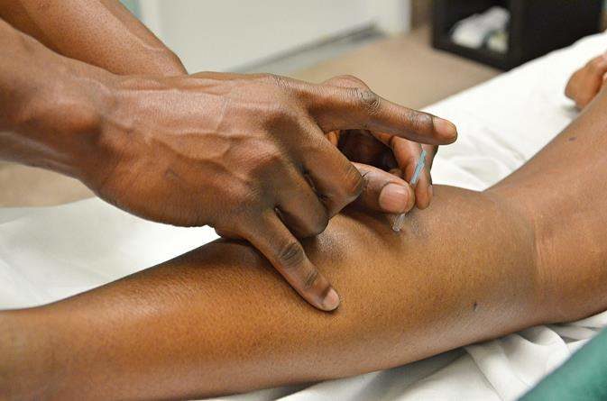 Acupuntura: Tratamento, técnicas e onde é usada